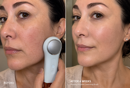 Vessora™ Pure Sonic Cleansing Brush